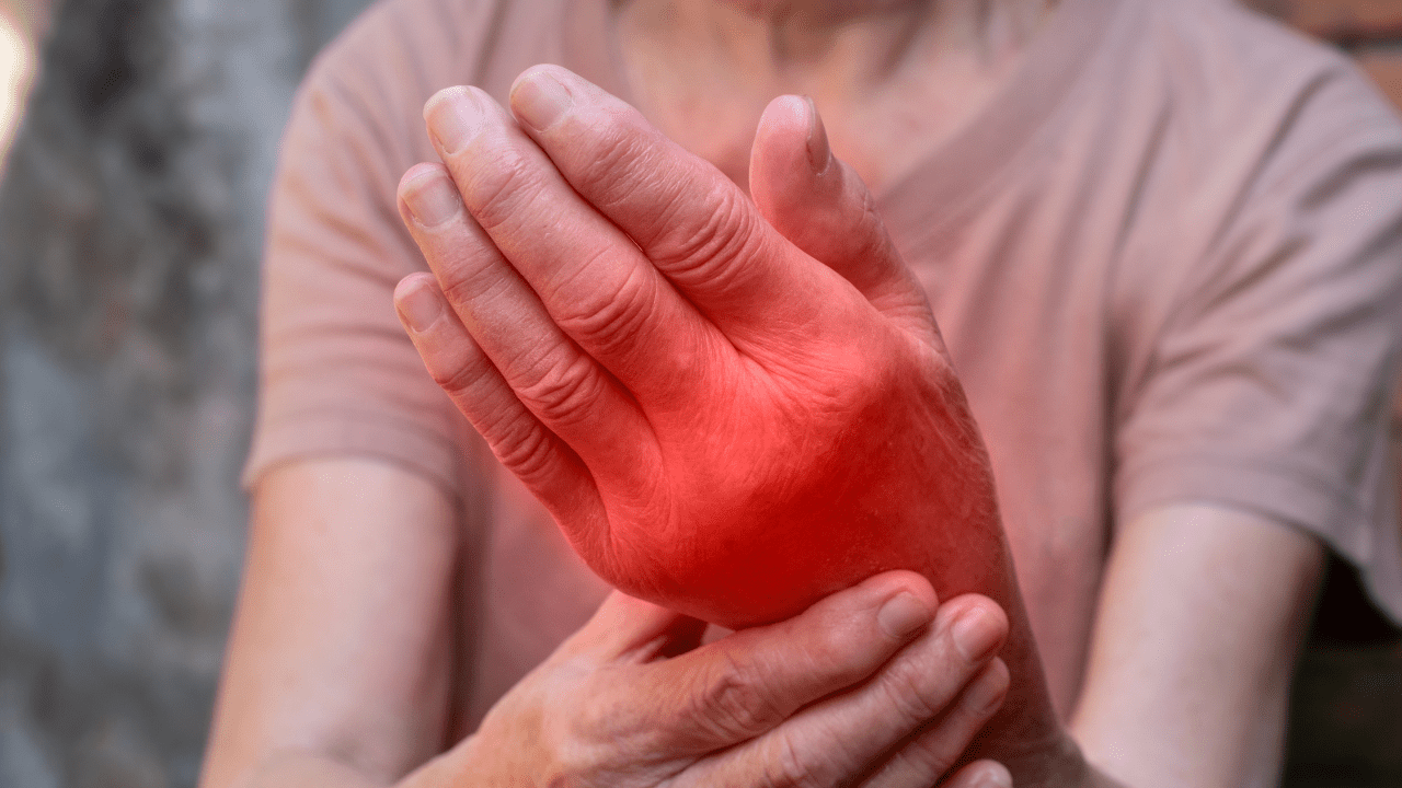 Hand Inflamed - Reducing Inflammation