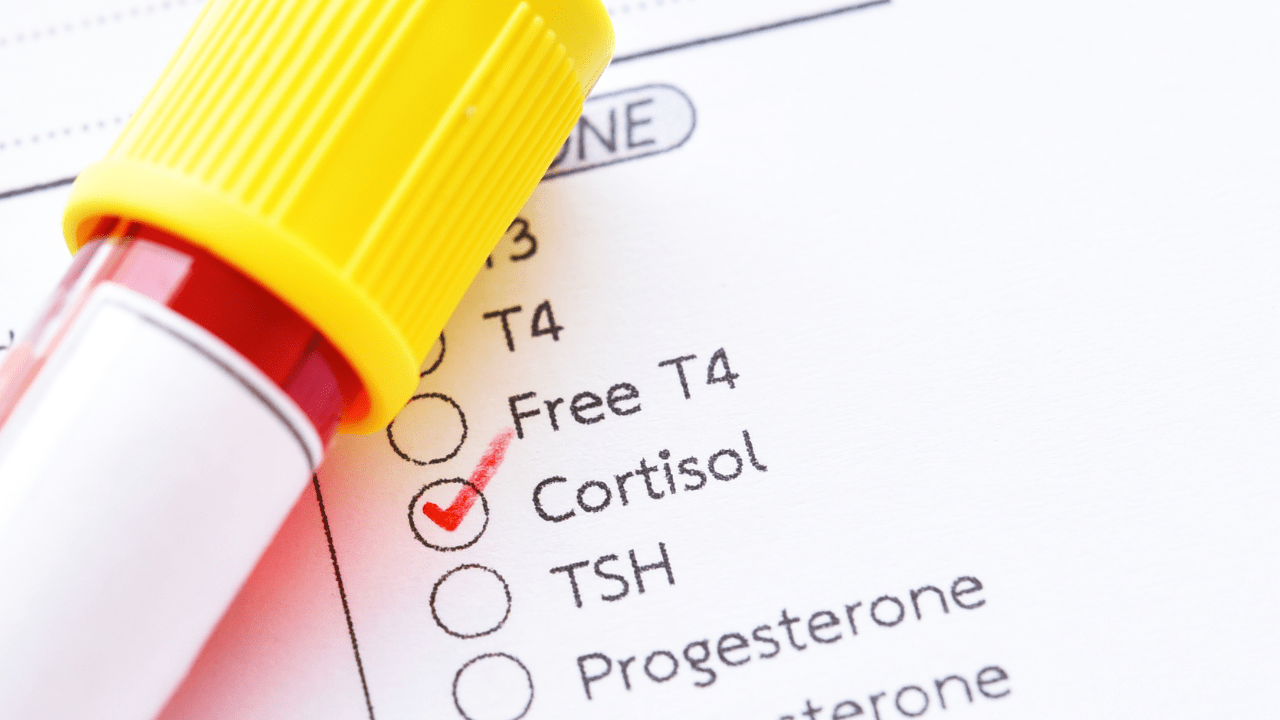 Cortisol, Hormones and Stress Eating