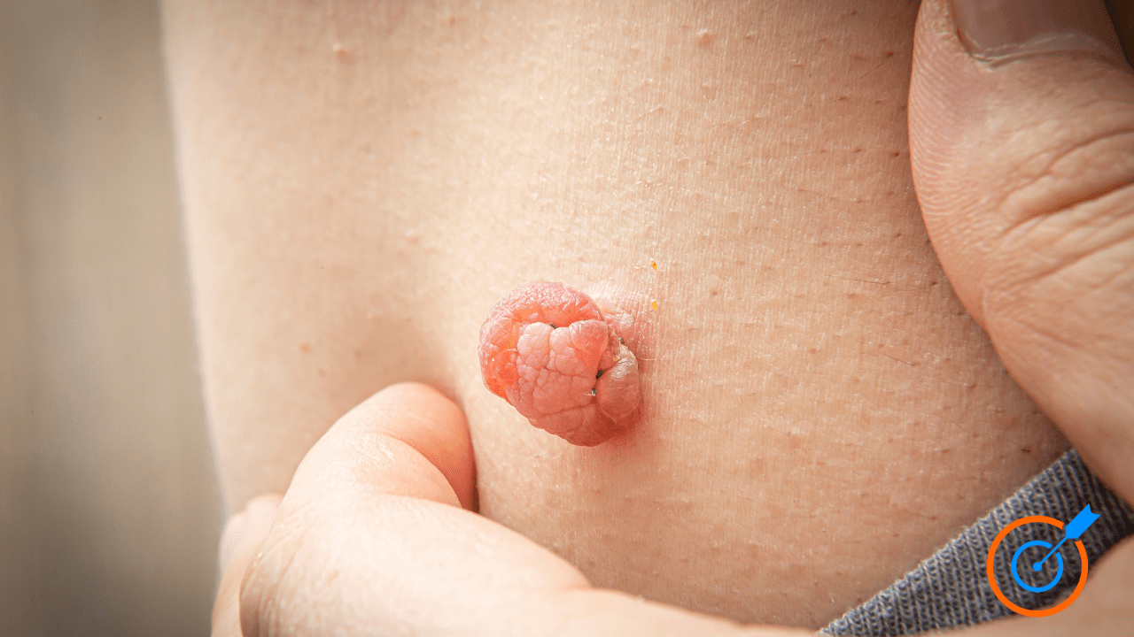 Insulin Resistance Symptoms Women Should Know