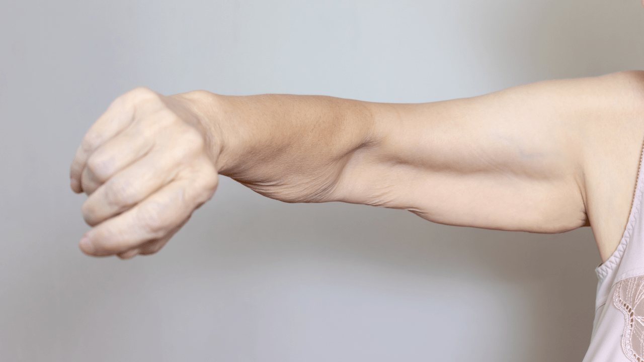 Woman Showing Muscle Loss - Weight Loss Drugs